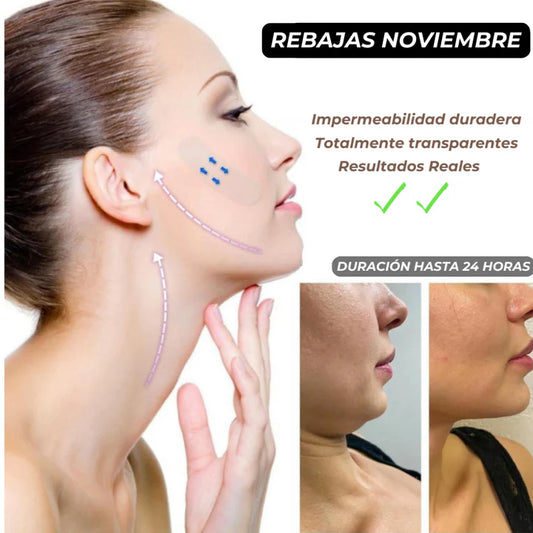 Lifting estiramiento facial - paga 30 lleva 60